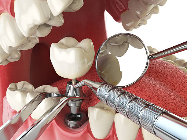 Best Emergency Treatment for Jaw Pain or Injury in USA
